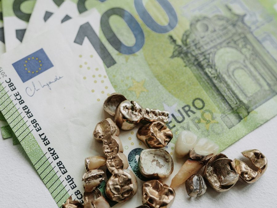 Ausgebautes Zahngold auf aufgefächerten Hundert-Euro-Scheinen