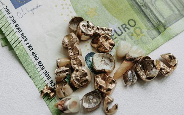 Ausgebautes Zahngold mit Goldkronen auf aufgefächerten Hundert-Euro-Scheinen